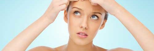 Acne and PCOS