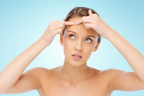 Acne and PCOS