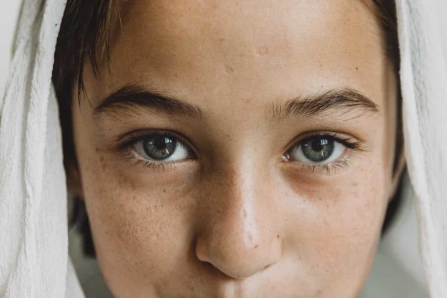 Diagnosis and Treatment of PCOS in Young Girls